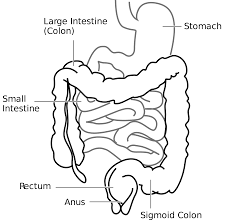 A CHRONIC CASE OF ILEO-COLITIS