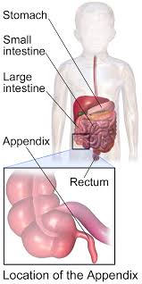 APPENDICITIS CURED BY MEDICINE